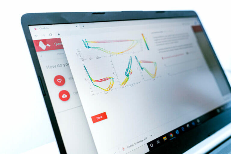Poročanje o kardiziografiji